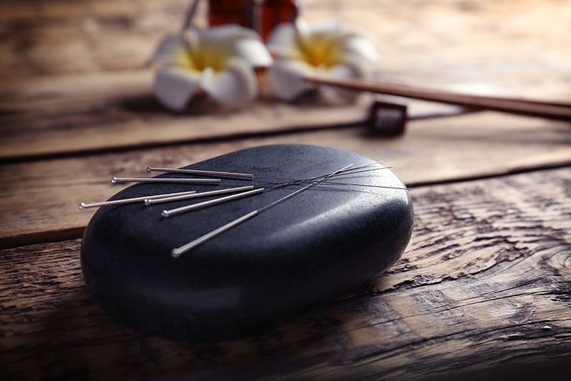 Vitality Acupuncture & Natural Medicine Needles