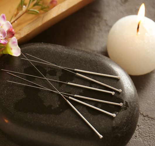 Vitality Acupuncture & Natural Medicine Needles
